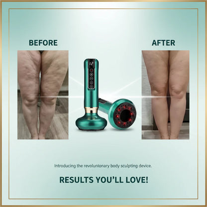 Anti-Cellulite Suction Cup